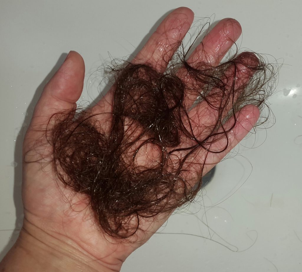 My extreme hair loss story - Pretty Please Charlie